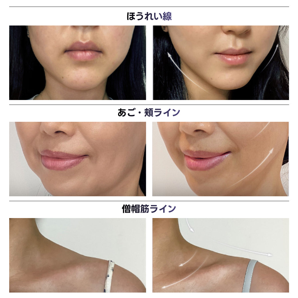 [日本公式] ハイパーグローショット